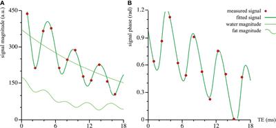 Gender- and Age-Associated Differences in Bone Marrow Adipose Tissue and Bone Marrow Fat Unsaturation Throughout the Skeleton, Quantified Using Chemical Shift Encoding-Based Water–Fat MRI